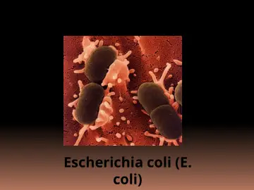 Slide 15: Escherichia coli (E. coli)