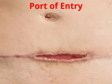 Slide 31: Port of Entry