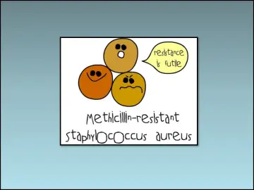 Slide 83: Work associated risks