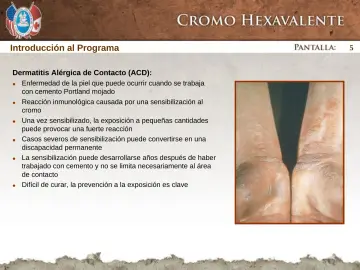 Slide 5: Introducción al Programa