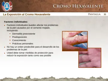 Slide 35: La Exposición al Cromo Hexavalente