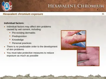 Slide 35: Hexavalent chromium exposure