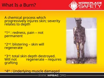 Slide 27: What Is a Burn?