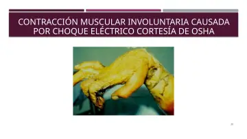 Slide 20: CONTRACCIÓN MUSCULAR INVOLUNTARIA CAUSADA