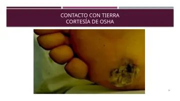 Slide 24: CONTACTO CON TIERRA