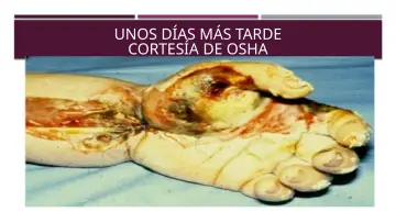 Slide 27: UNOS DÍAS MÁS TARDE