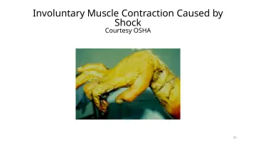 Slide 20: Involuntary Muscle Contraction Caused by Shock