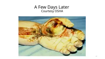 Slide 27: A Few Days Later