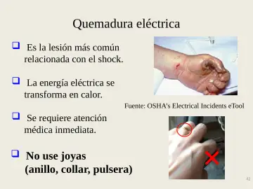Slide 42: Quemadura eléctrica