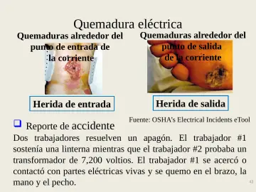 Slide 43: Quemadura eléctrica