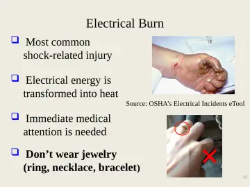Slide 42: Electrical Burn