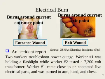 Slide 43: Electrical Burn
