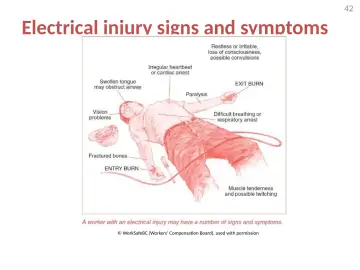 Slide 42: Electrical injury signs and symptoms