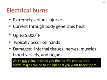 Slide 47: Electrical burns
