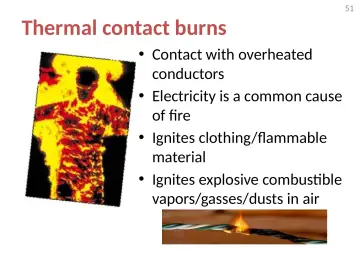 Slide 51: Thermal contact burns