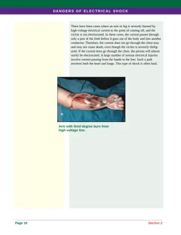 Page 18: There have been cases where an arm or leg is severely burned by high-voltage electrical…