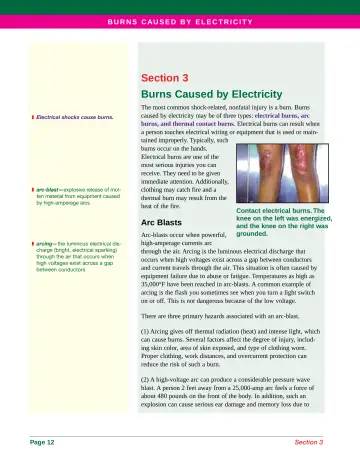 Page 20: Section 3 Burns Caused by Electricity