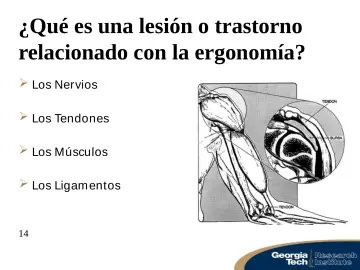 Slide 14: ¿Qué es una lesión o trastorno relacionado con la ergonomía?