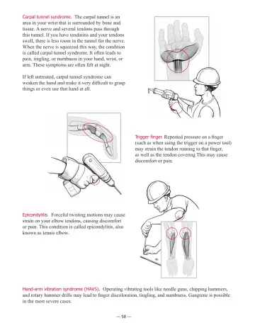 Page 60: If left untreated, carpal tunnel syndrome can