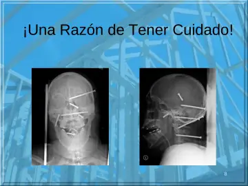 Slide 8: ¡Una Razón de Tener Cuidado!