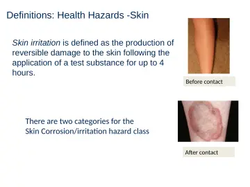 Slide 30: Definitions: Health Hazards -Skin