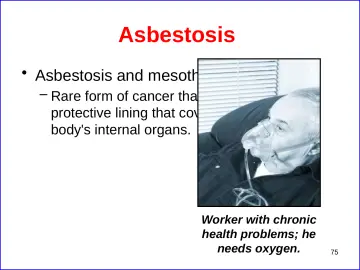 Slide 75: Asbestosis