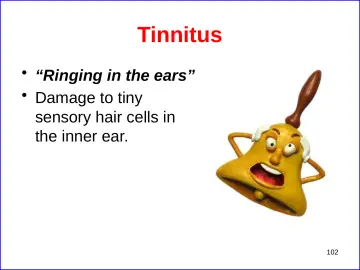 Slide 102: Tinnitus