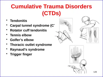 Slide 126: Cumulative Trauma Disorders (CTDs)