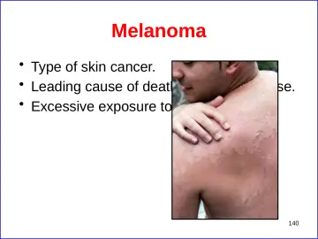 Slide 140: Melanoma