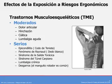 Slide 19: Efectos de la Exposición a Riesgos Ergonómicos