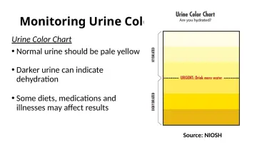 Slide 28: Monitoring Urine Color