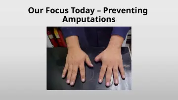 Slide 11: Our Focus Today – Preventing