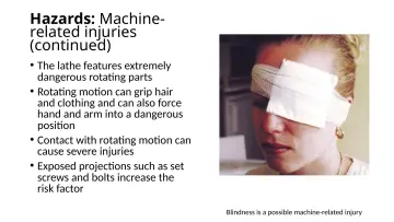 Slide 7: Hazards: Machine-related injuries (continued)