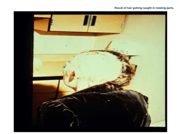 Slide 68: Result of hair getting caught in rotating parts.