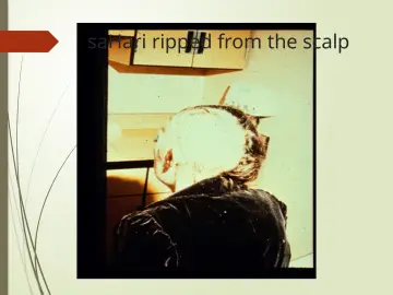 Slide 24: saHari ripped from the scalp