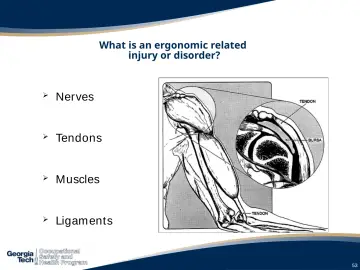 Slide 53: What is an ergonomic related injury or disorder?