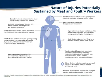 Slide 55: Nature of Injuries Potentially Sustained by Meat and Poultry Workers