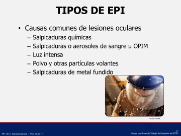 Slide 17: Causas comunes de lesiones oculares