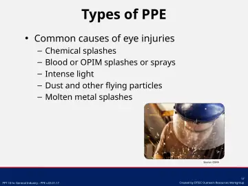 Slide 17: Common causes of eye injuries