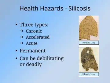 Slide 11: Health Hazards - Silicosis