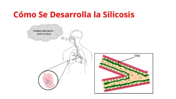 Slide 10: Cómo Se Desarrolla la Silicosis
