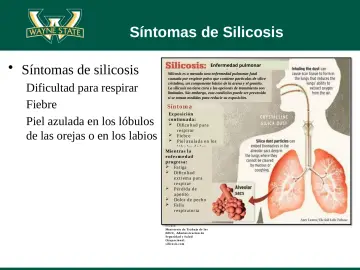 Slide 20: Síntomas de Silicosis