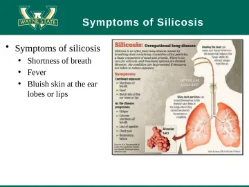 Slide 20: Symptoms of Silicosis