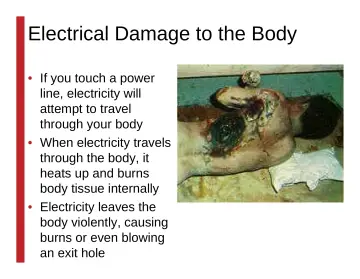 Slide 44: Electrical Damage to the Body